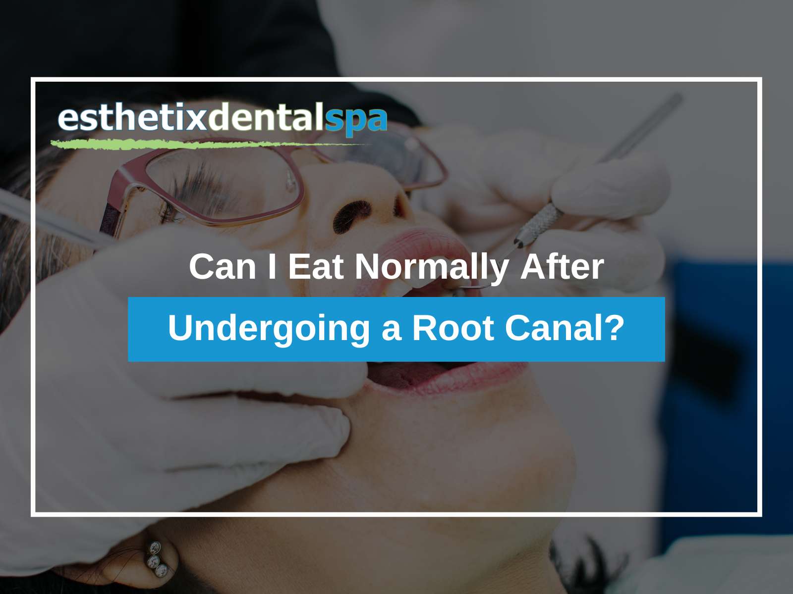 Can I Eat Normally After Undergoing a Root Canal