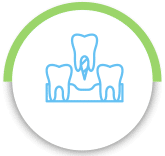 You Need Dental Implants To Replace Missing Teeth
