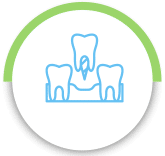 You Need Dental Implants To Fill Gaps And Replace Missing Teeth