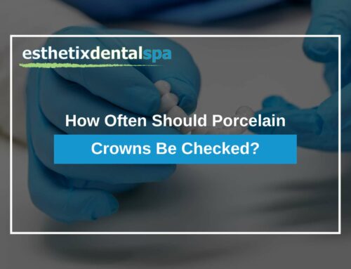How Often Should Porcelain Crowns Be Checked?