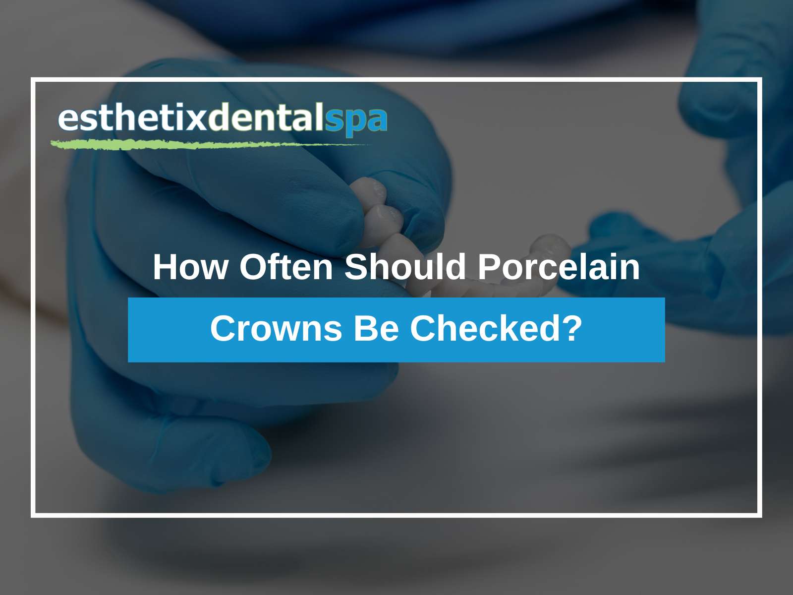 How Often Should Porcelain Crowns Be Checked