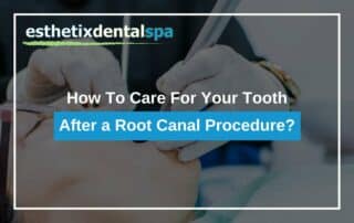 How To Care For Your Tooth After a Root Canal Procedure