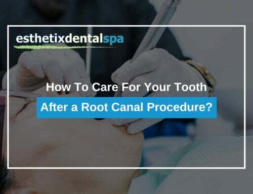 How To Care For Your Tooth After a Root Canal Procedure?
