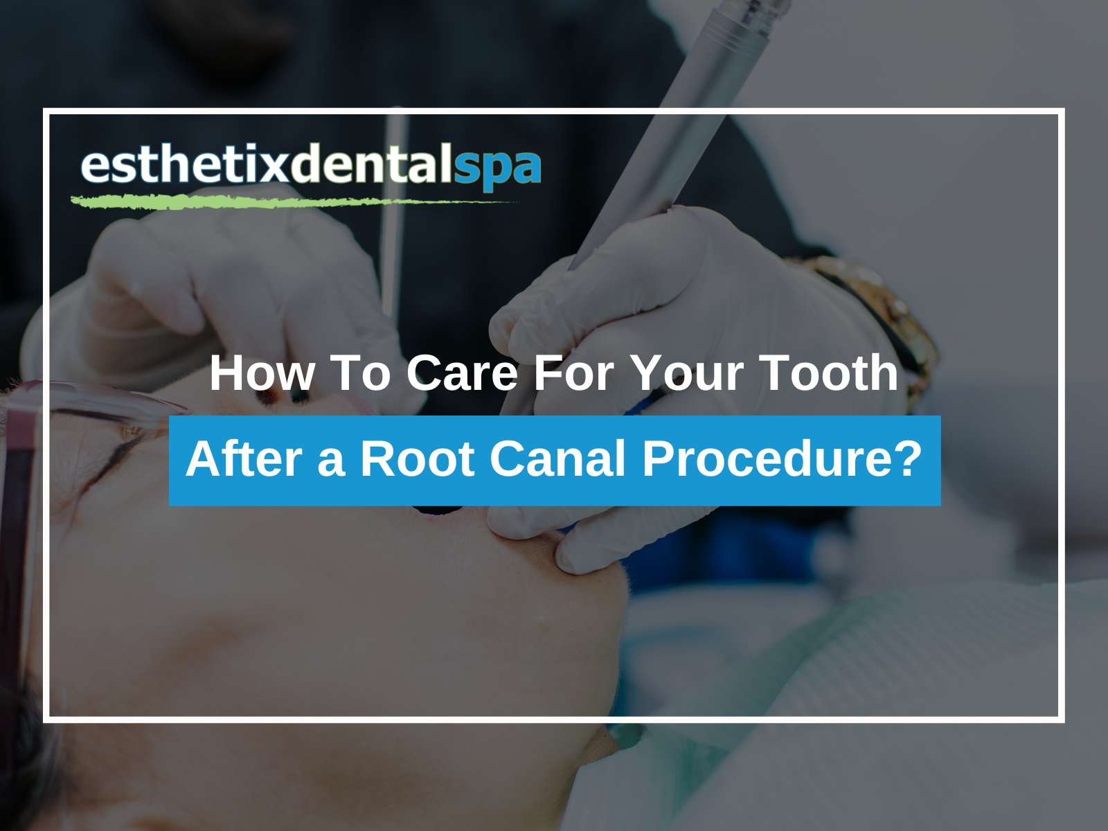 How To Care For Your Tooth After a Root Canal Procedure