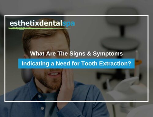 What Are The Signs & Symptoms Indicating a Need for Tooth Extraction?