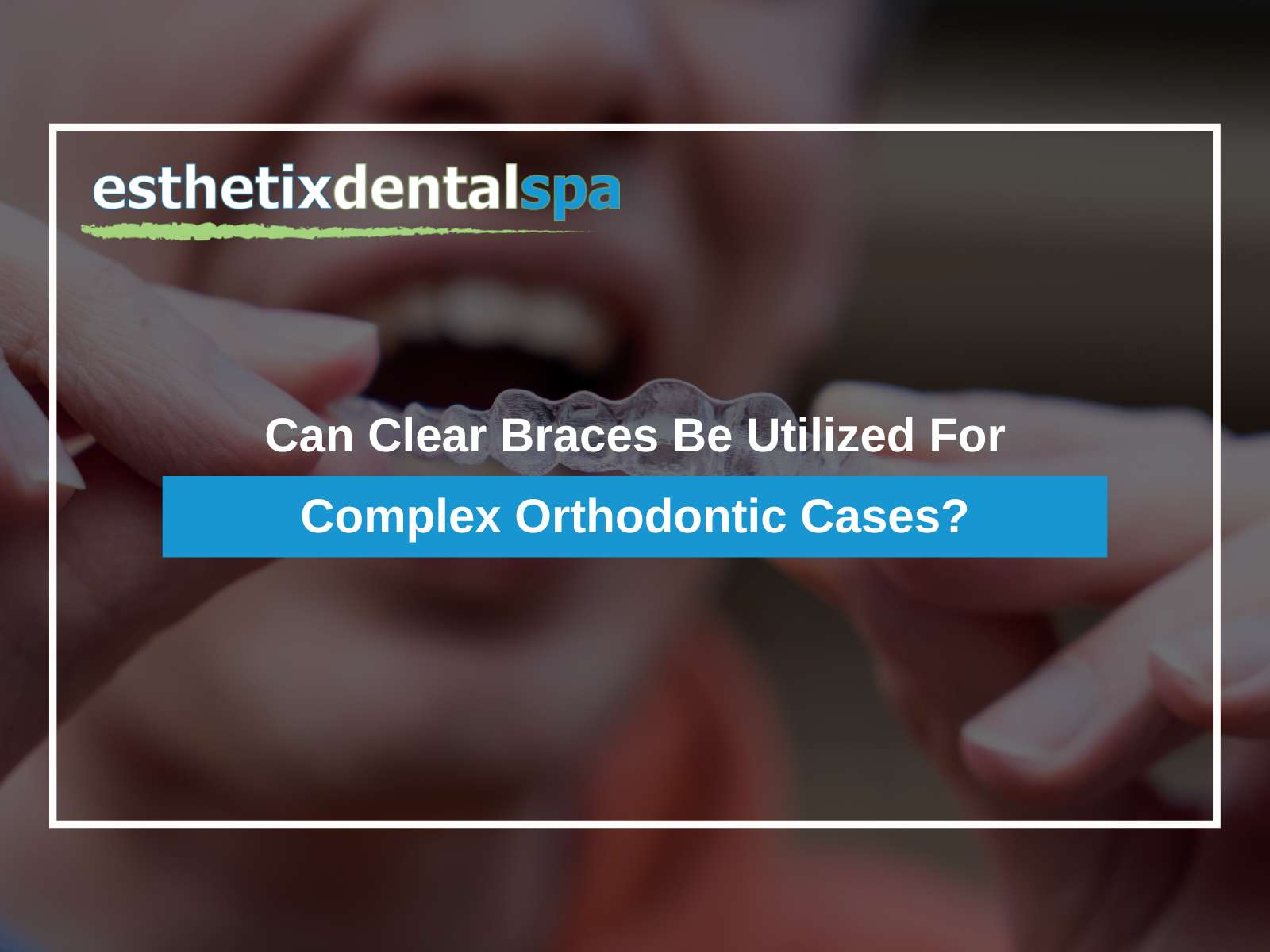 Can Clear Braces Be Utilized For Complex Orthodontic Cases