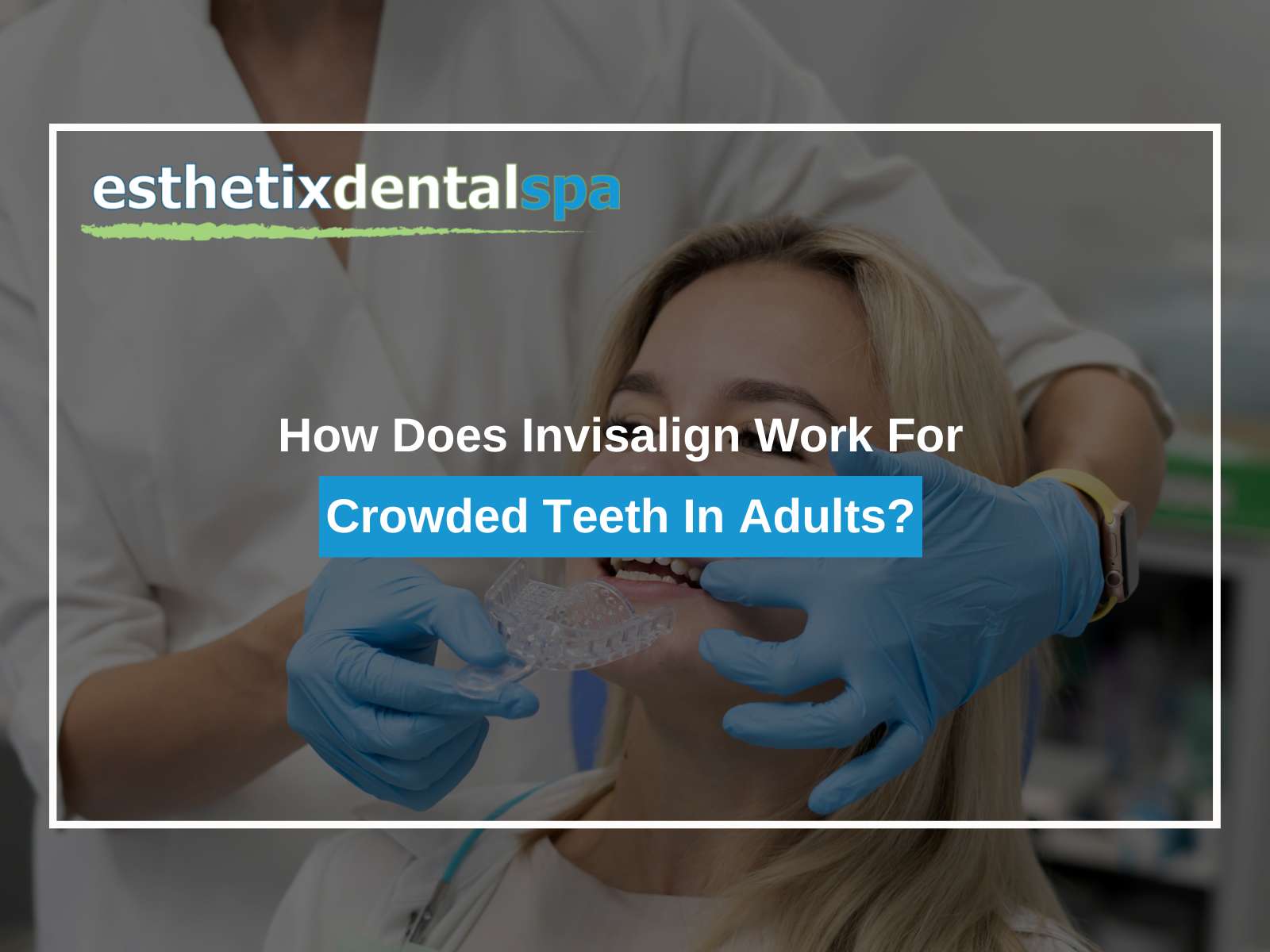 How Does Invisalign Work For Crowded Teeth In Adults