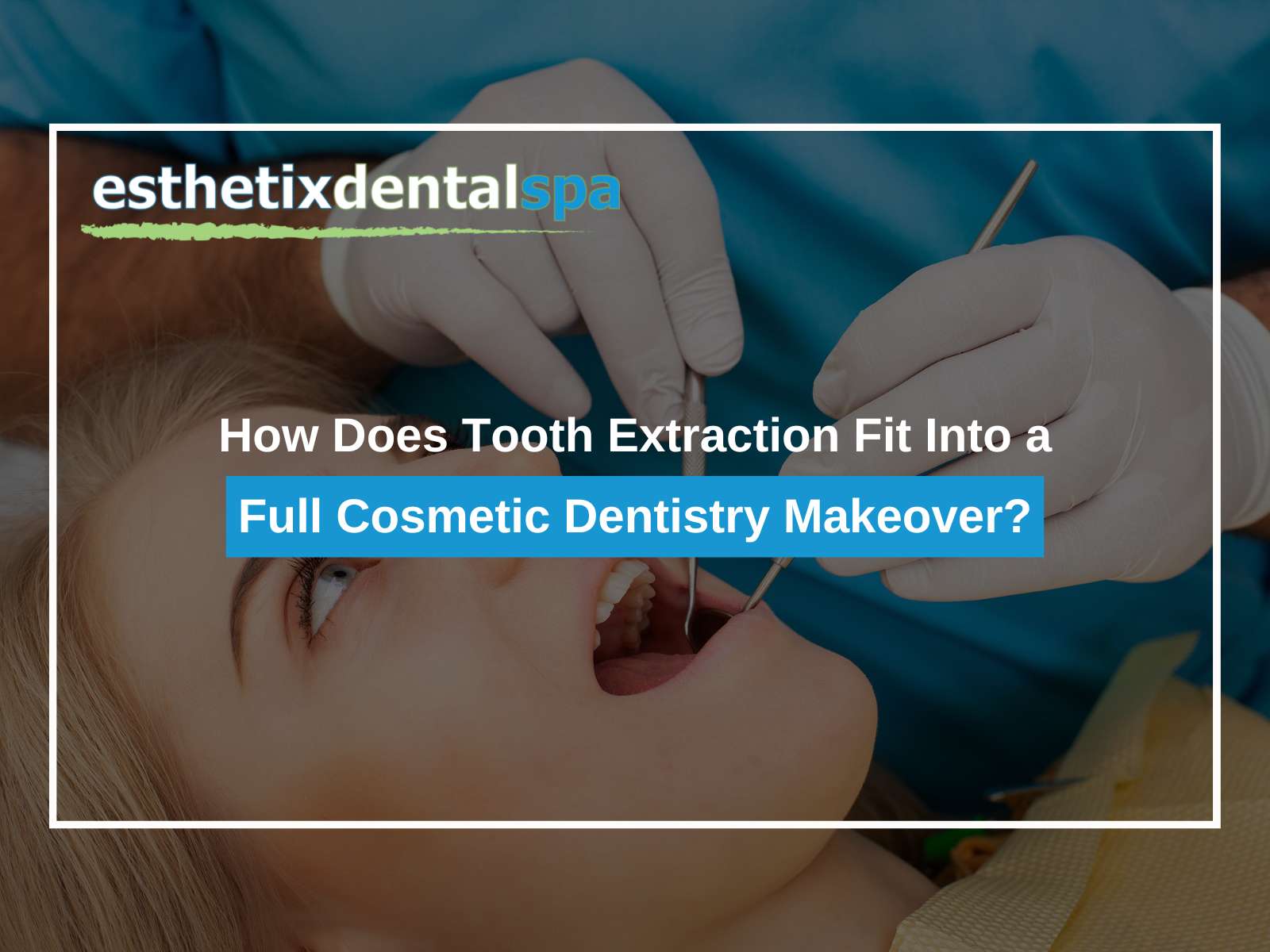 How Does Tooth Extraction Fit Into a Full Cosmetic Dentistry Makeover