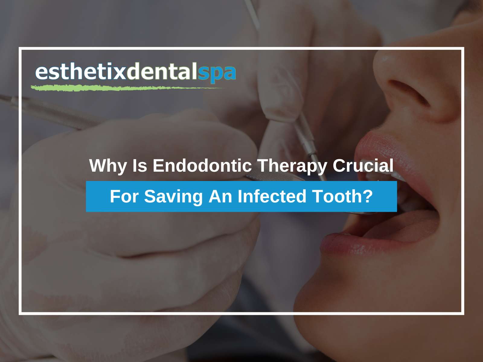 Why Is Endodontic Therapy Crucial For Saving An Infected Tooth?