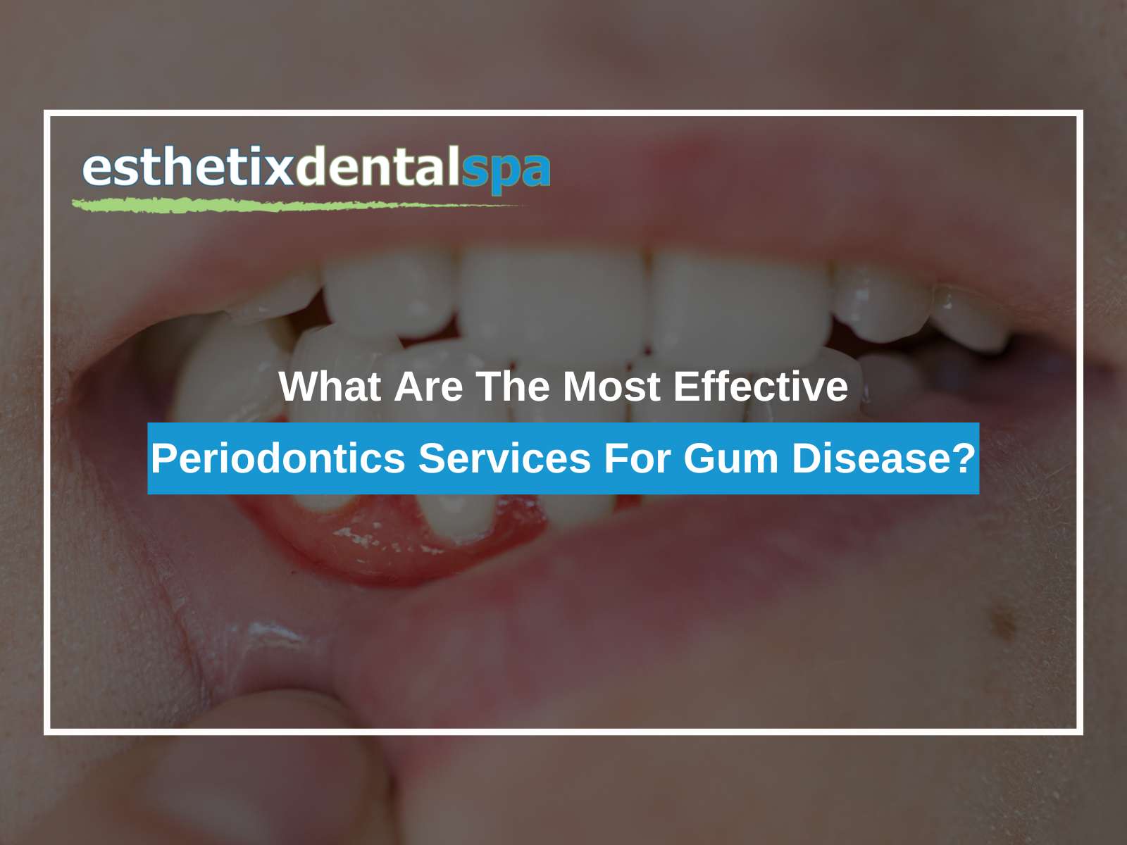 What Are The Most Effective Periodontics Services For Gum Disease