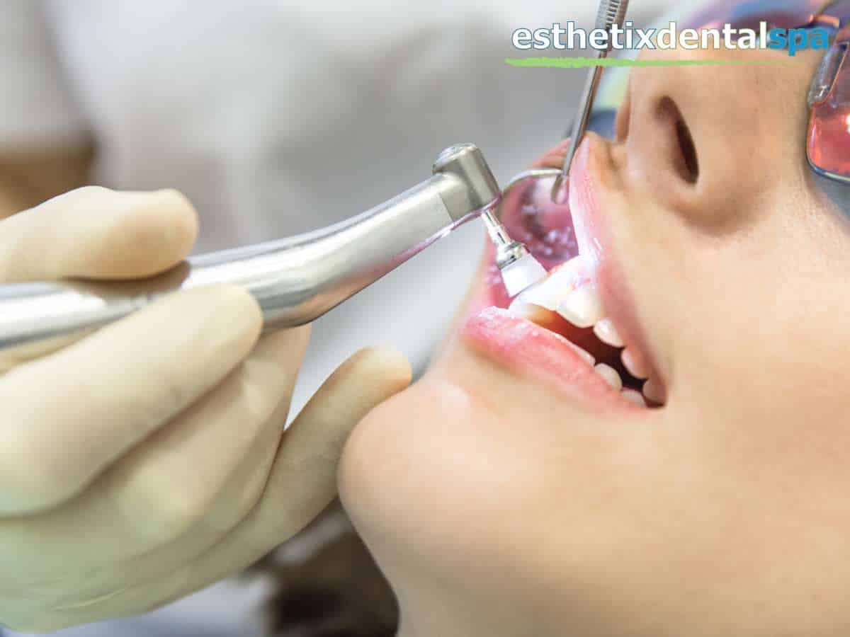 A patient receiving periodontics services, with a dentist using a dental handpiece for treatment