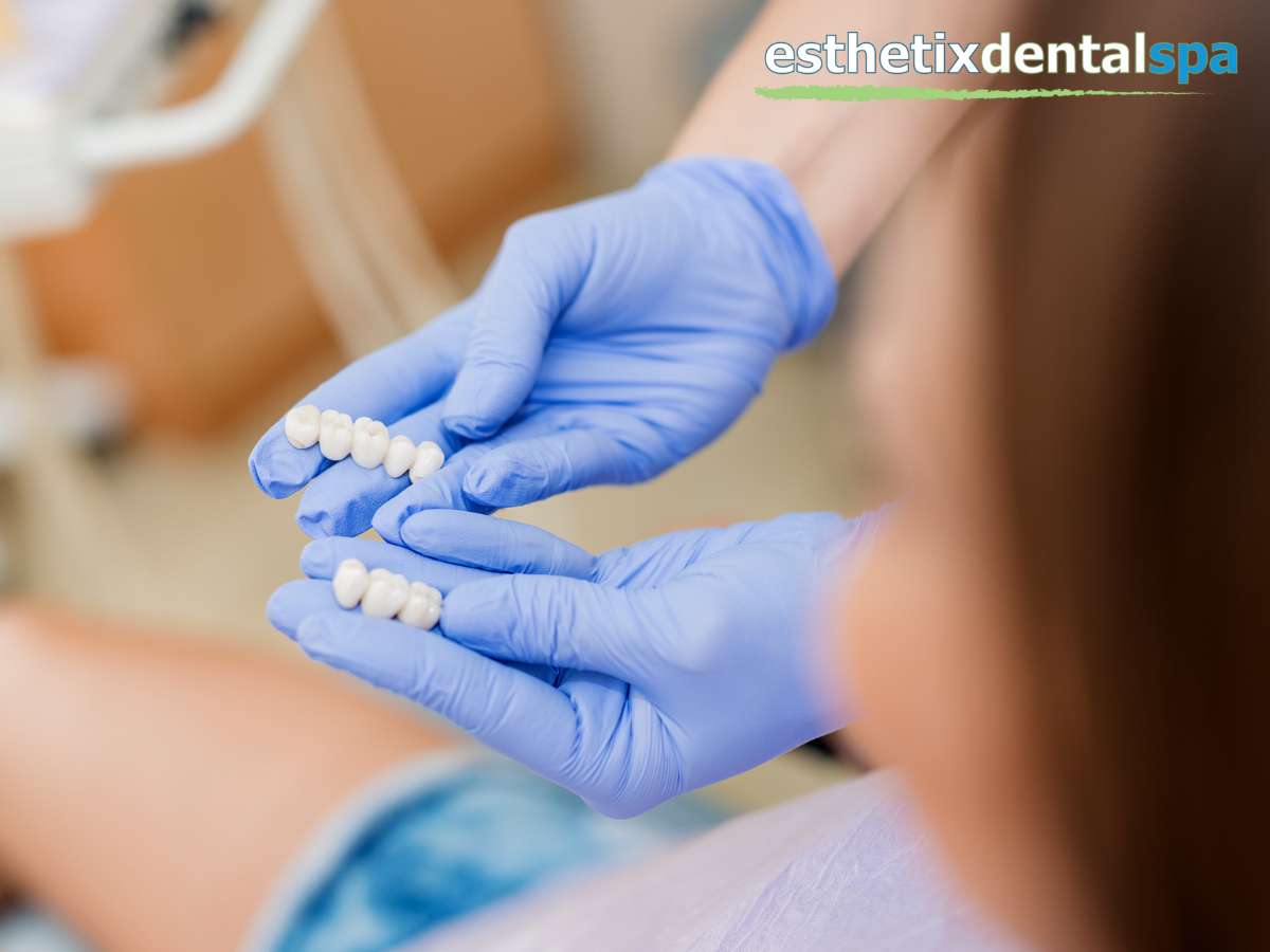 Dentist holding a model of teeth to discuss Porcelain Crowns vs. Composite Fillings with a patient