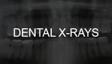 Dental X-Rays