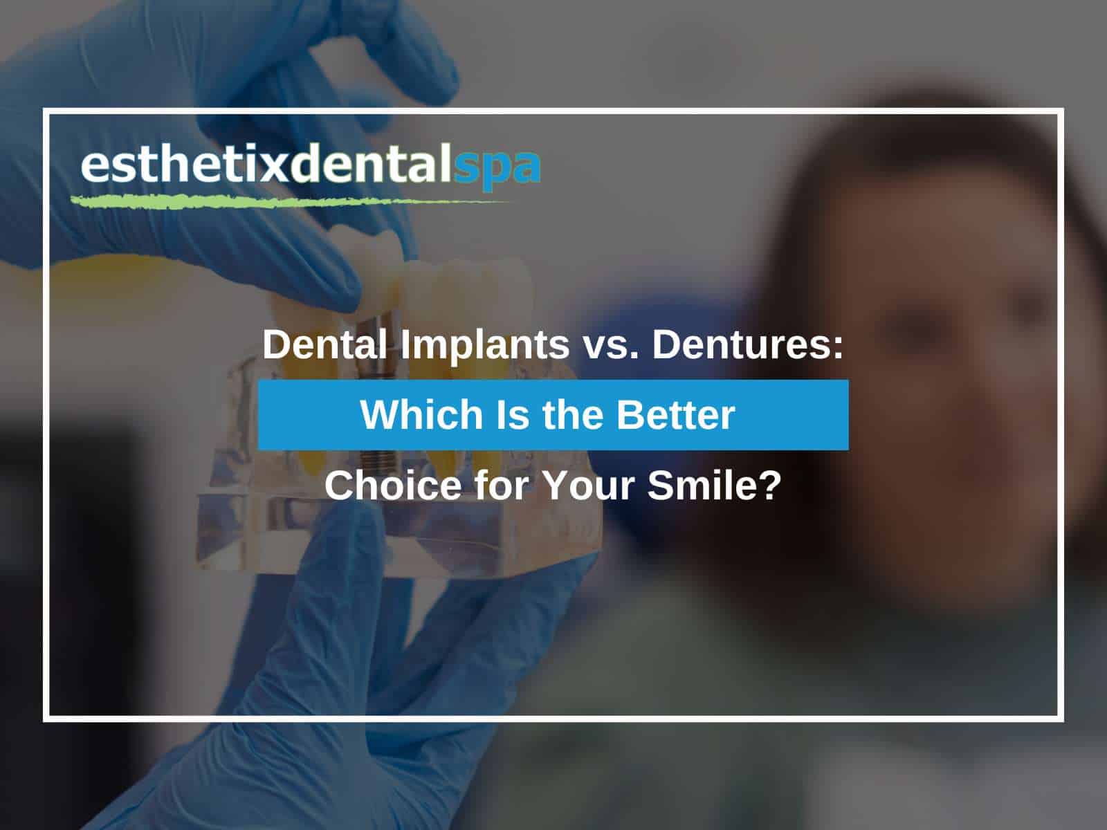 Dental Implants vs. Dentures: Which Is the Better Choice for Your Smile?